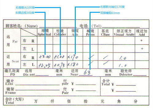 验光单完全看不懂 看完这篇让你成为半个验光师