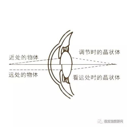 什么是医学验光 为什么说医学验光才准确