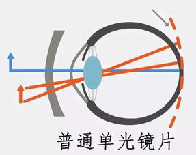 你学生时期换过多少副眼镜